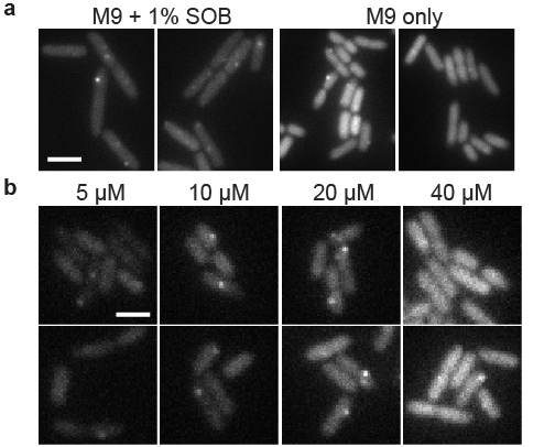Figure 3: Using IPTG to tune expression of a fluorescent RNA-binding protein for single mRNA detection in different growth conditions. (a) PP7cp-SYFP2 is induced with 100 µM IPTG to detect single mVenus-Cro mRNA molecules in supplemented media and minimal media conditions; in minimal media there is too high a PP7cp-SYFP expression level to see single mRNA spots above background. Scale bar 4 µm. (b) Using the pJS102 expression system, an optimal range of 10—20 µM IPTG is quickly identified for single mRNA detection in minimal media. Scale bar 2 µM. Two example images are shown for each condition. Images were taken shortly after preparing samples, so adjacent cells are not usually closely related in cell lineages.